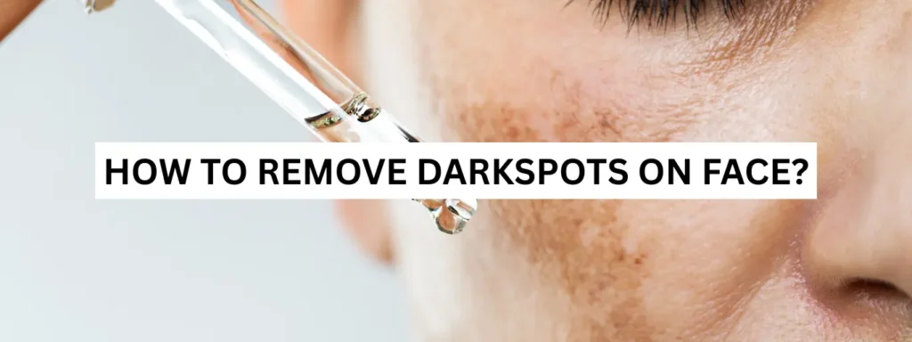 How to Remove Dark Spots from the Face?