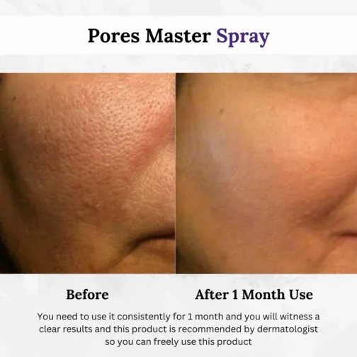 Loyal Body Pores Master Spray Before And After